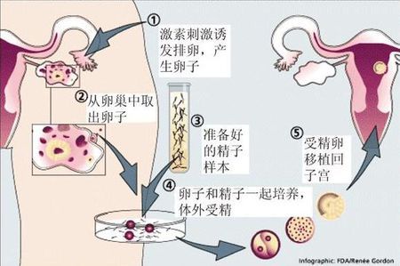 爱心同性供卵代孕微信群